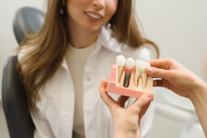 Dental Patient Getting Shown A Dental Implant Model During Her Consultation in Prairieville, LA