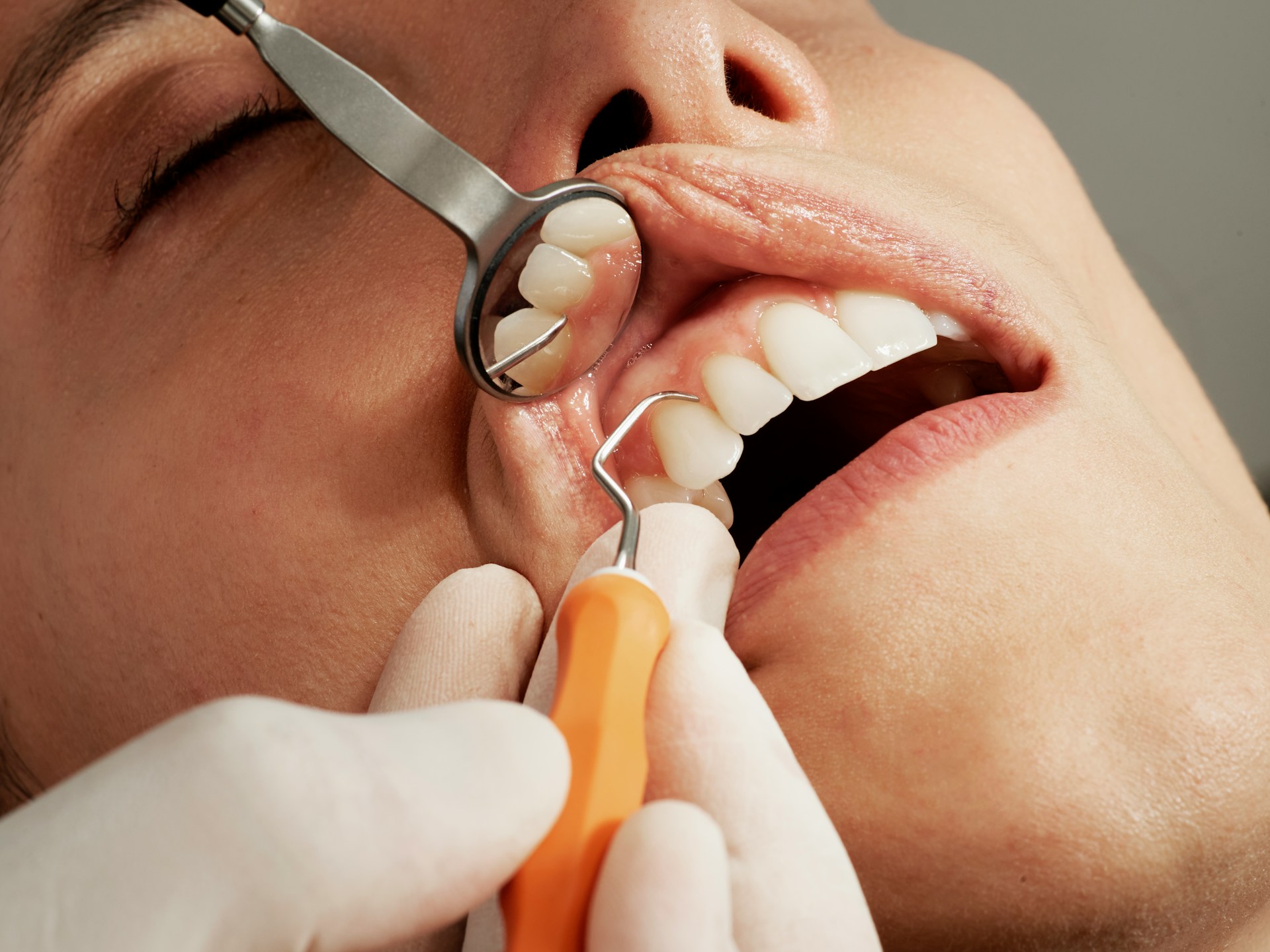 Dental Work