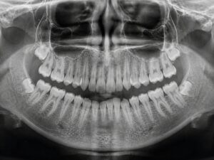 Jawbone