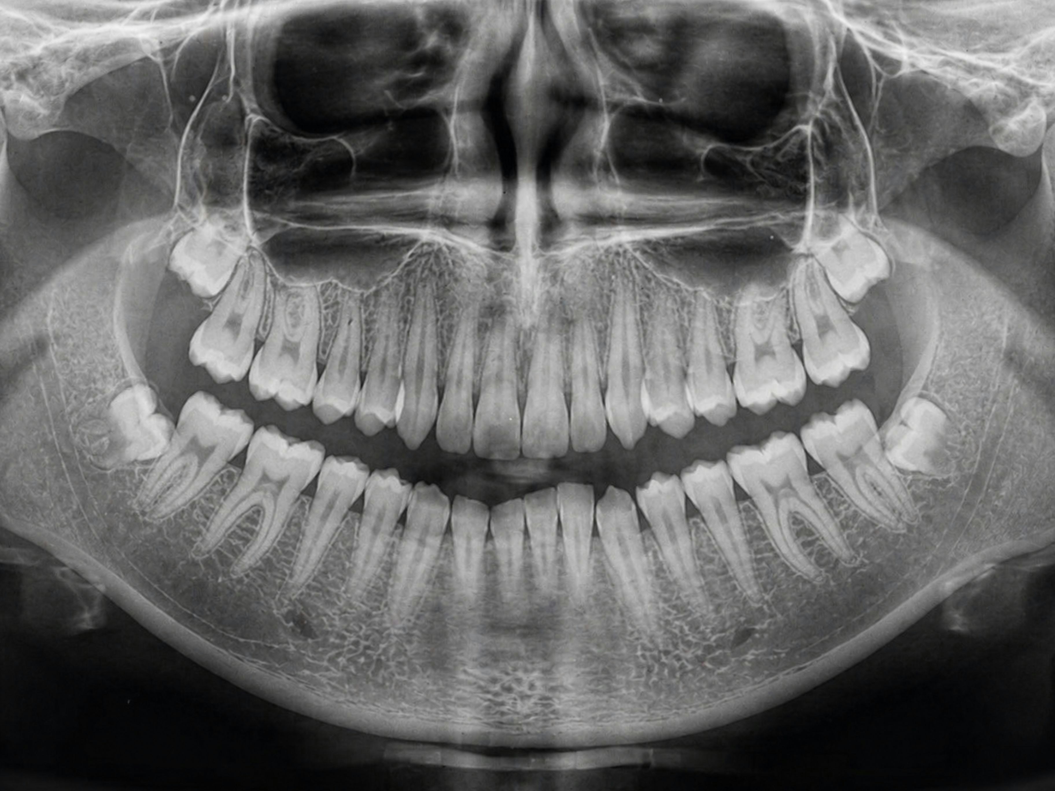 Jawbone